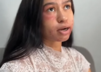 D1000007 Olha oque filho fez part2