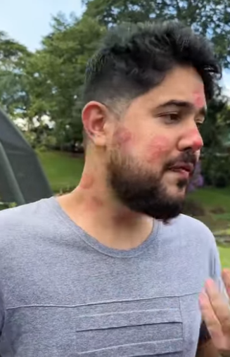 D2000007 Ela procurou colágen part2